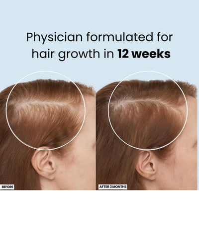 Clarenecare Advanced Hair Growth Roll-On Serum